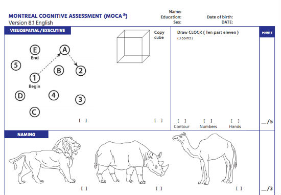 montreal cognitive assessment test known as moca